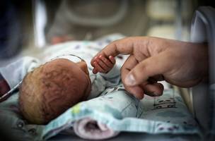 Mortalidade infantil diminui no mundo. (Foto: Divulgação/ Ascom)