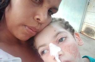 Mãe faz campanha para manter tratamento de filho com traqueostomia em casa. (Foto: Reprodução/ Arquivo Pessoal)