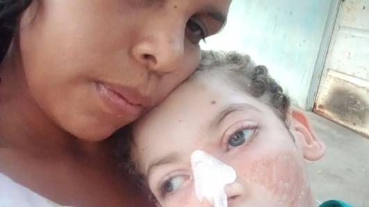 Mãe faz campanha para manter tratamento de filho com traqueostomia em casa