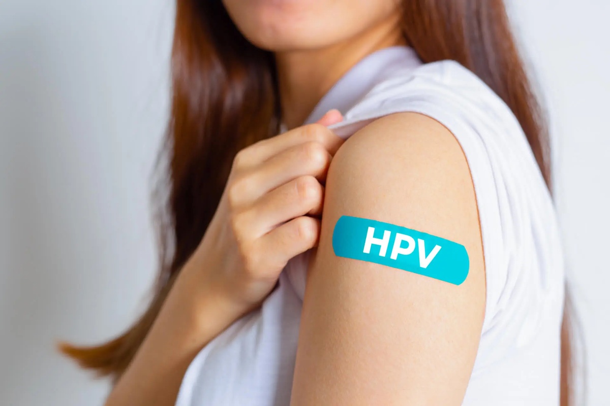 Exame que detecta HPV.