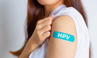 Exame que detecta HPV: FMS faz mutirão para mulheres de 25 a 64 anos em Teresina